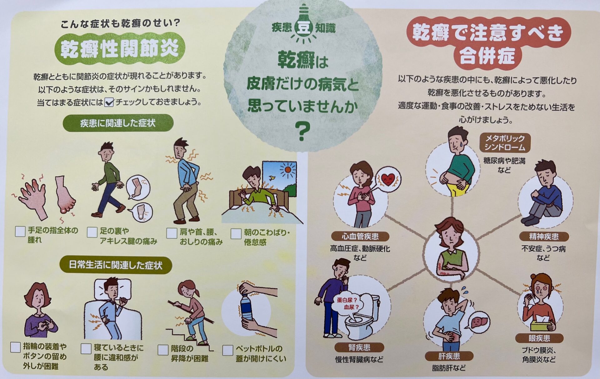 手の乾癬性関節炎の症状